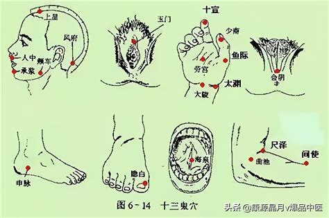 十三鬼穴位置|中醫針灸「十三鬼穴」